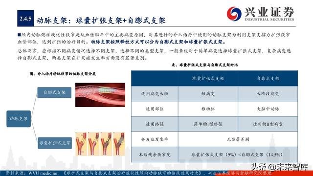 神经介入器械投资策略：百亿市场尚处起步期，国产替代潜力巨大