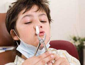 咳咳咳，孩子咳嗽总也好不了怎么办！专家给你最全答案