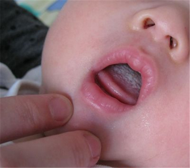 宝宝咳嗽祛痰不对症，会有大麻烦！每个妈妈都该收藏的食谱