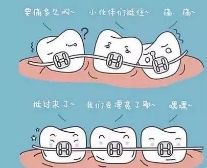 牙齿矫正究竟要多久？