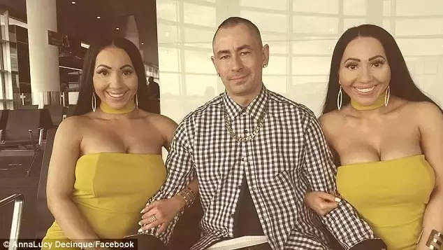 澳洲这对奇葩双胞胎姐妹花,一起整容,现在要嫁给同一个男人啦