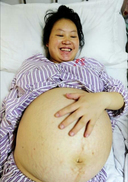 怀孕3个月肚子大的走不动路，分娩生出4胞胎家人高兴的合不拢嘴