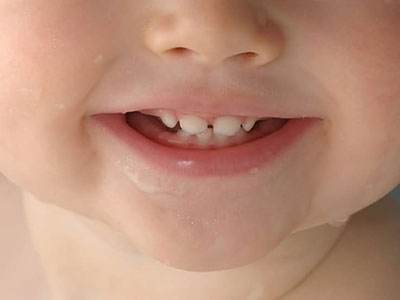 你知道吗？孩子的“门牙”形状，可以透露出他的性格特点！