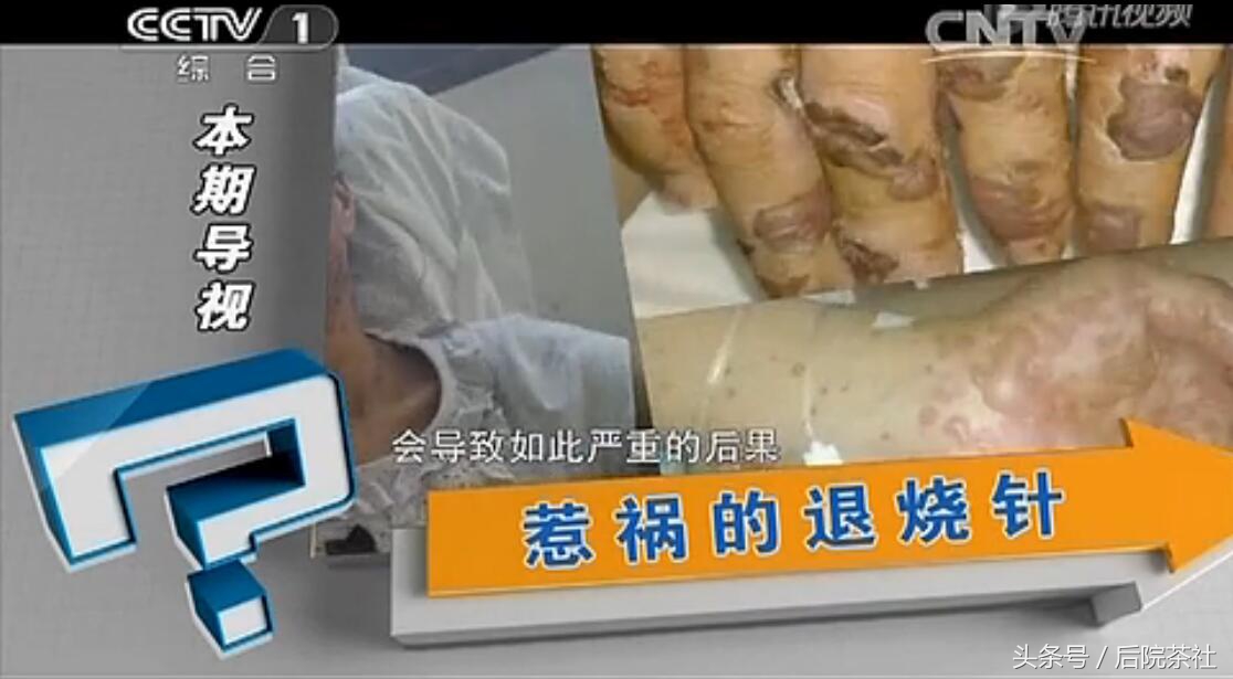什么情况下才要打退烧针