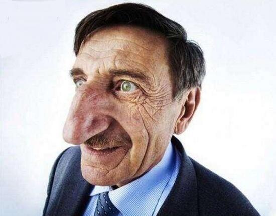 梅赫梅特奥兹约雷克是个57岁的建筑者,由于他的巨型鼻子而闻名该国