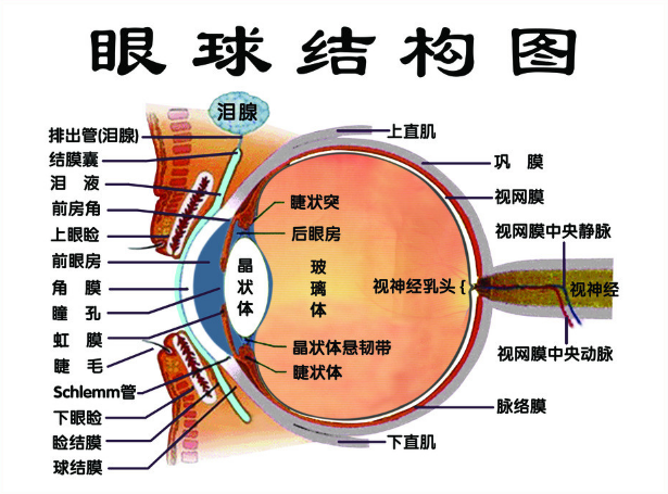 真正的，能根治高度近视眼的方法