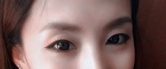 眼窝深不是欧美风，那是胶原蛋白流失！