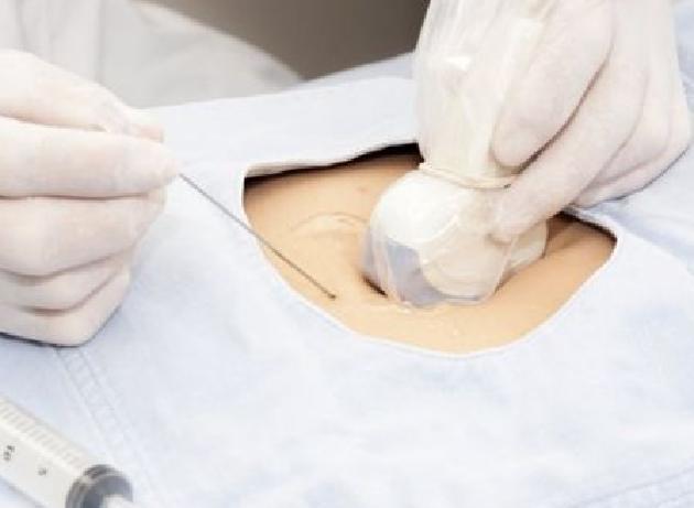 怀孕四个月宝宝b超能看出胎儿的性别吗?