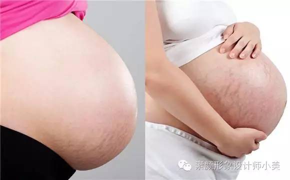 孕育课堂：怀孕三十五周 胎儿发育与孕妈变化