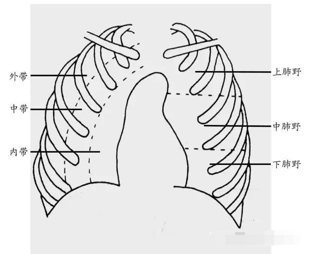 肺野的划分图图片