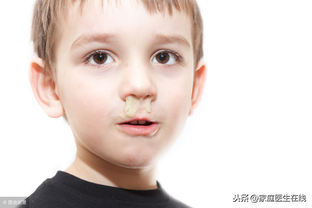 鼻炎早期有4个表现！家长多提醒三件事，孩子逃离鼻炎“魔掌”