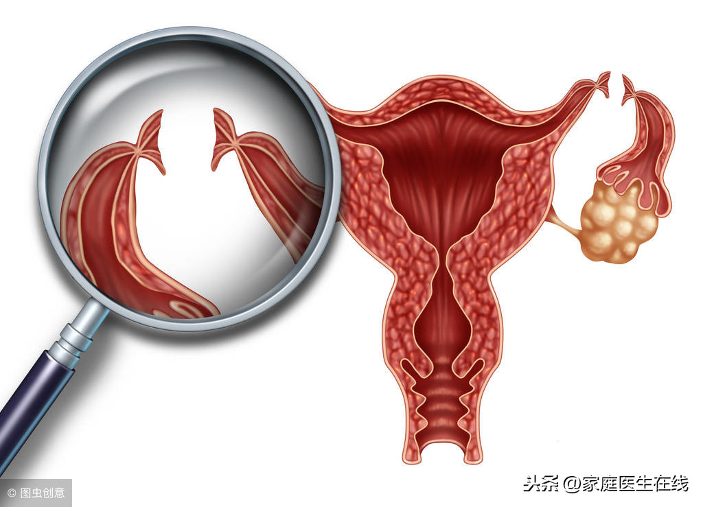 出现异常输卵管先天性的发育异常,比如输卵管过长或者输卵管缺如等