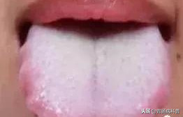 什么是脾虚？脾虚了怎么办？10个食疗方让脾不再“虚”