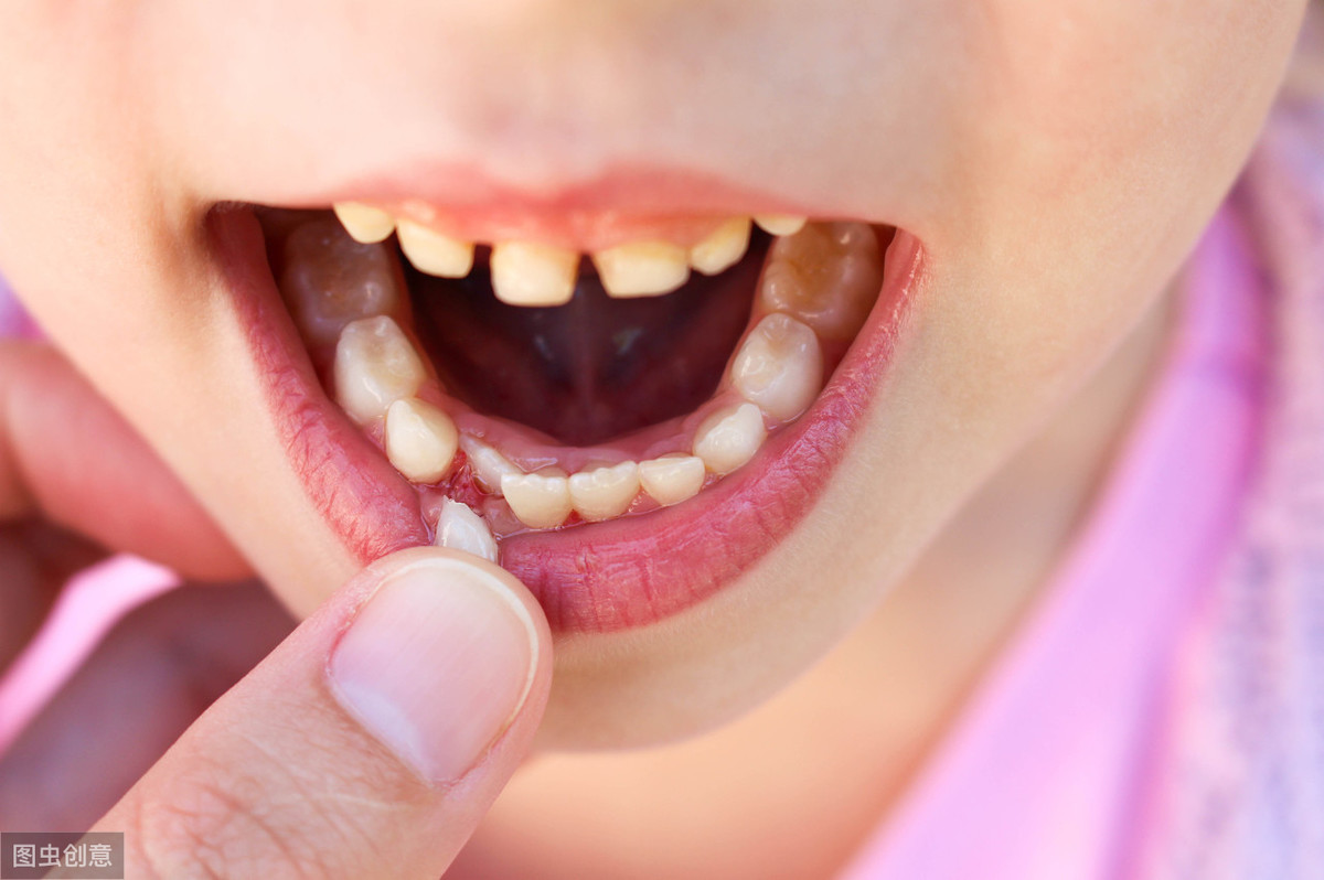 牙齿开裂，一般由3个原因导致！牙科医生教你正确的治疗方法