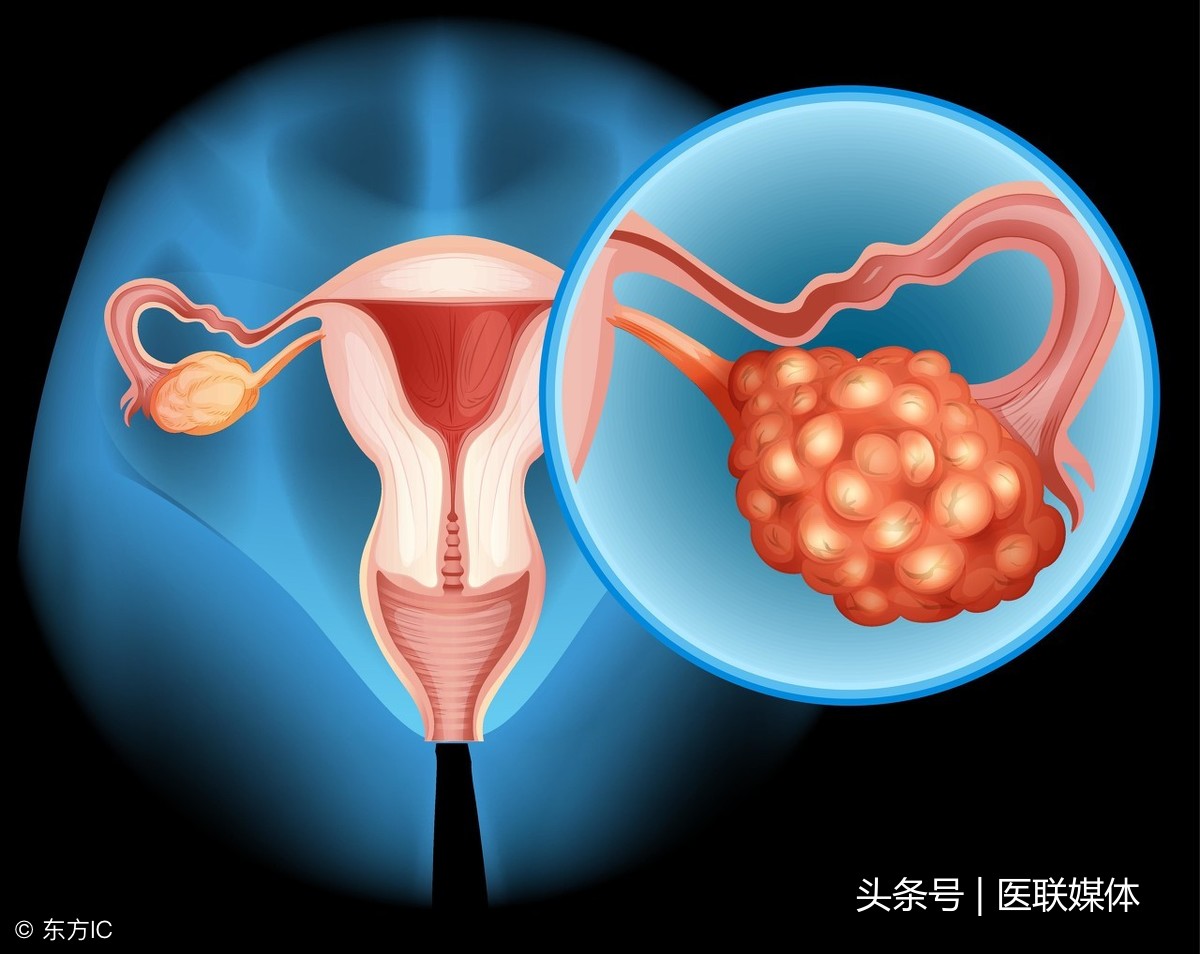 卵巢功能衰退，多与这2大因素有关，希望你不会中招