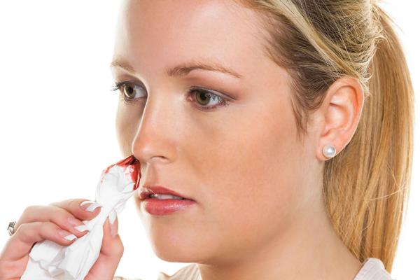 经常流鼻血是怎么回事？提醒：或是这些因素引起，这样做可缓解