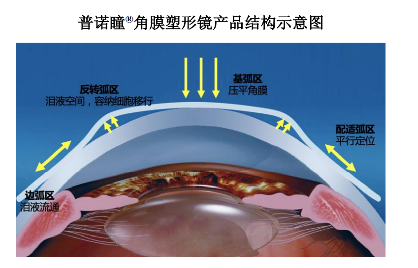 眼科新锐爱博医疗，凭技术开疆拓土，又欲将高端产品销往全球