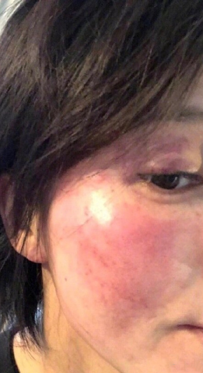 实锤来了？王雨馨和黄景瑜的结婚照、自杀诊断书和家暴诊断书曝光