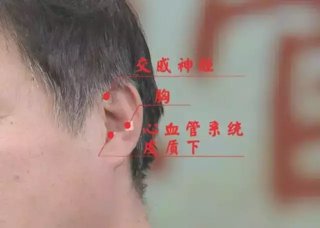 两个妙招,三大穴位!防治心血管疾病,中西医各显神通-第9张图片-农百科 两个妙招,三大穴位!防治心血管疾病,中西医各显神通-第9张图片-农百科