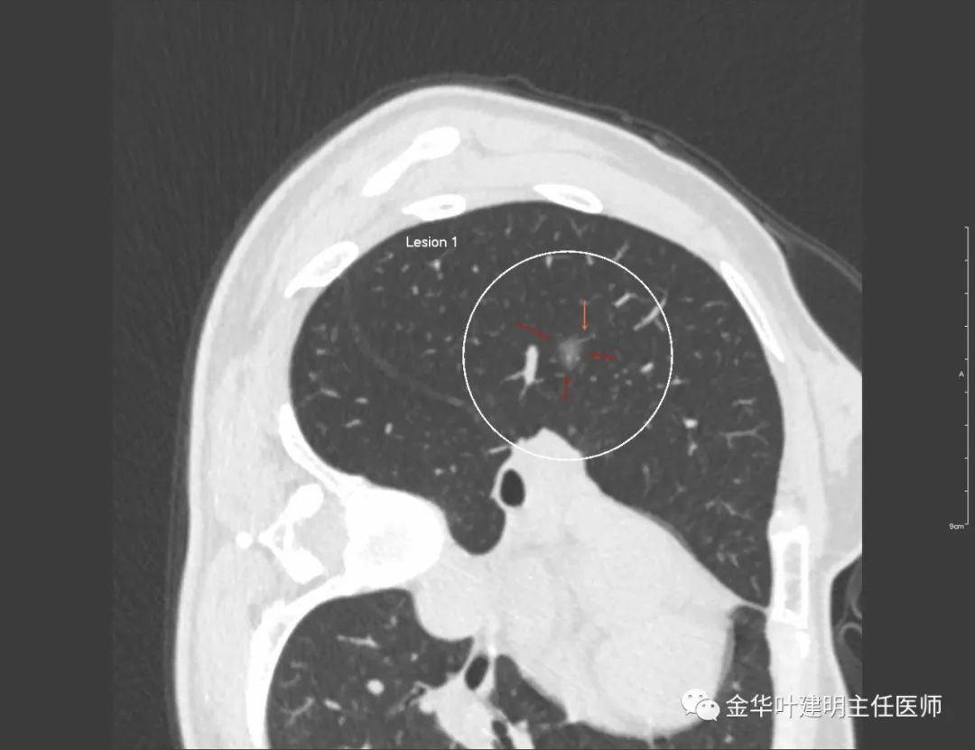 043c14a1adc64860a11f60279cb144c9?from=pc