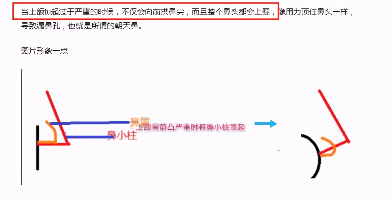 赵丽颖非纯天然美女？黑粉晒图力证做正颌手术，网友看后质疑整容