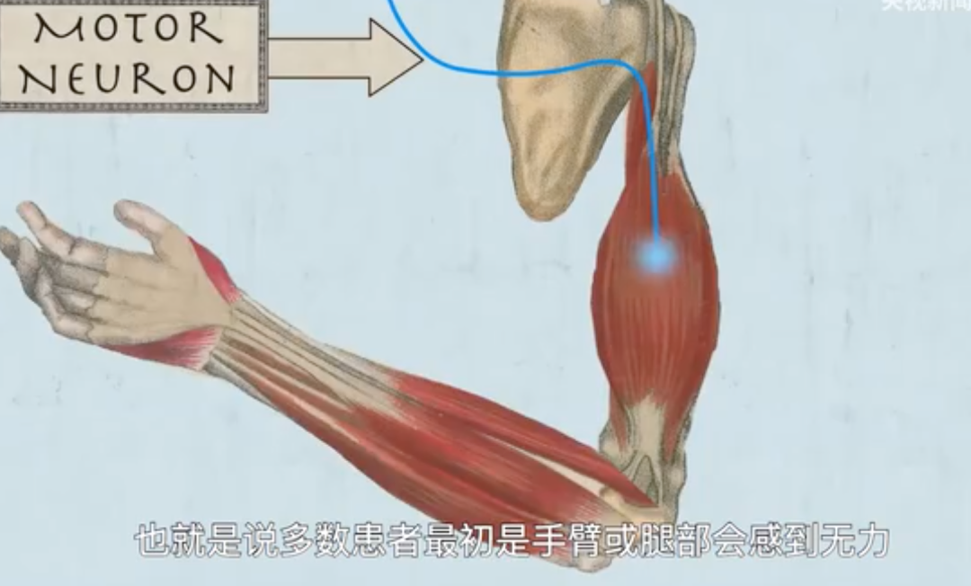 武汉那个患上绝症的医生，需要自救