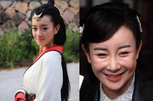 从娄艺潇到蔡明，恐怖的“硅胶脸”之下，为什