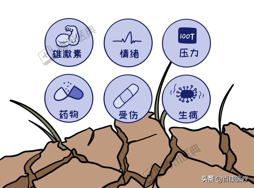 90后小伙竟秃成了50岁大叔丨脱发，如何自救？