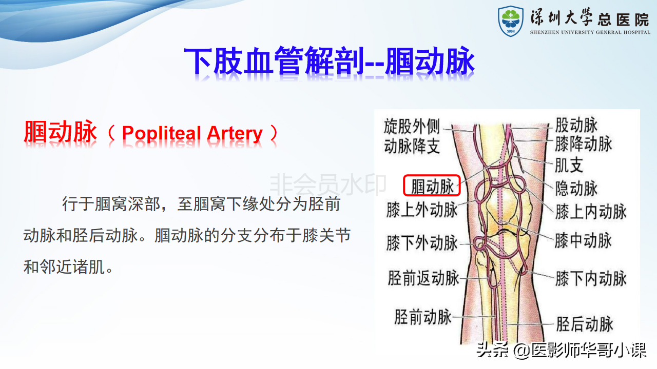 磁共振非增强双下肢血管MRA