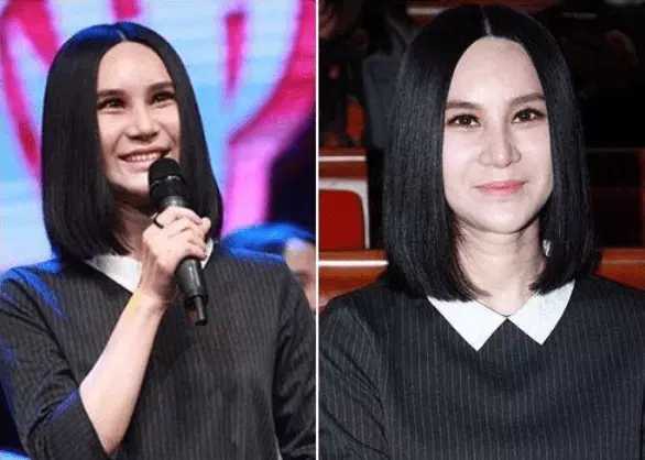 整容失败的10位明星，谁堪称“阴影”之最？