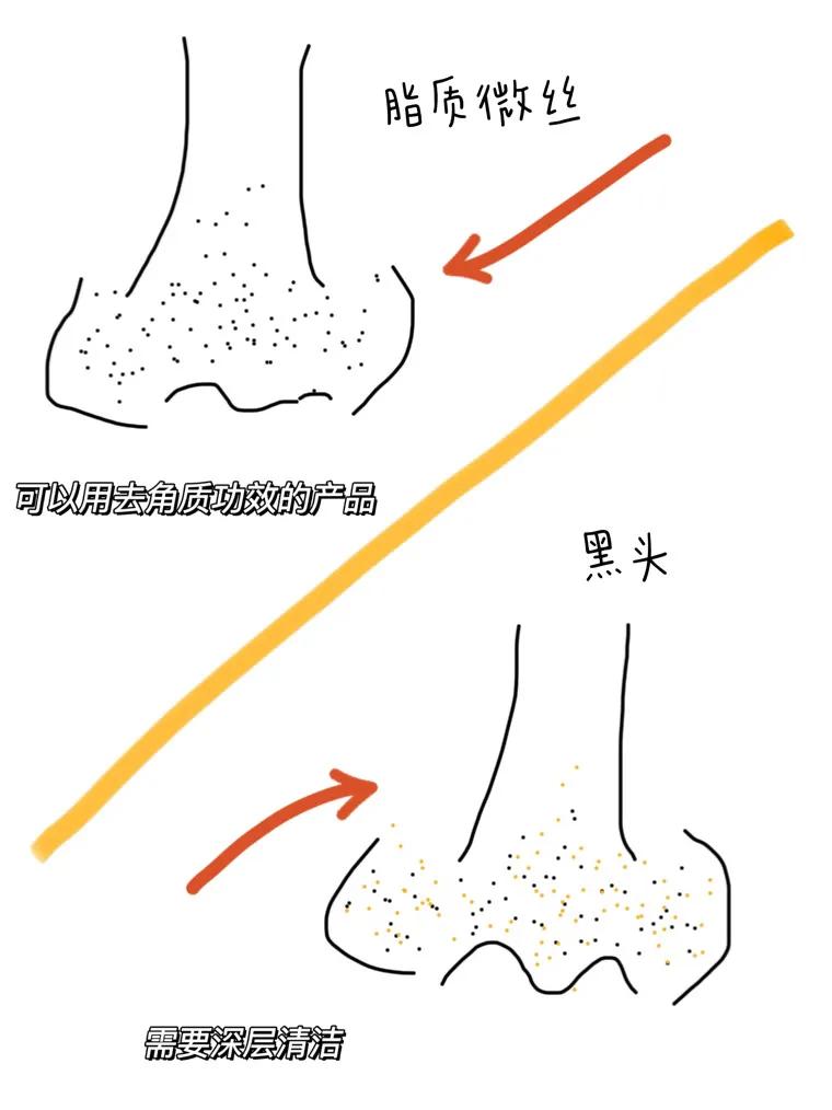 姐妹們原來這樣去黑頭才是正確的