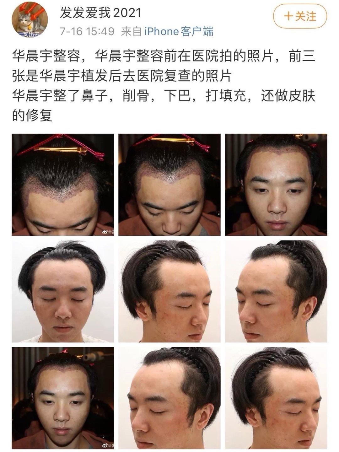华晨宇终究会躲过一劫，张碧晨将一直活得像个笑话