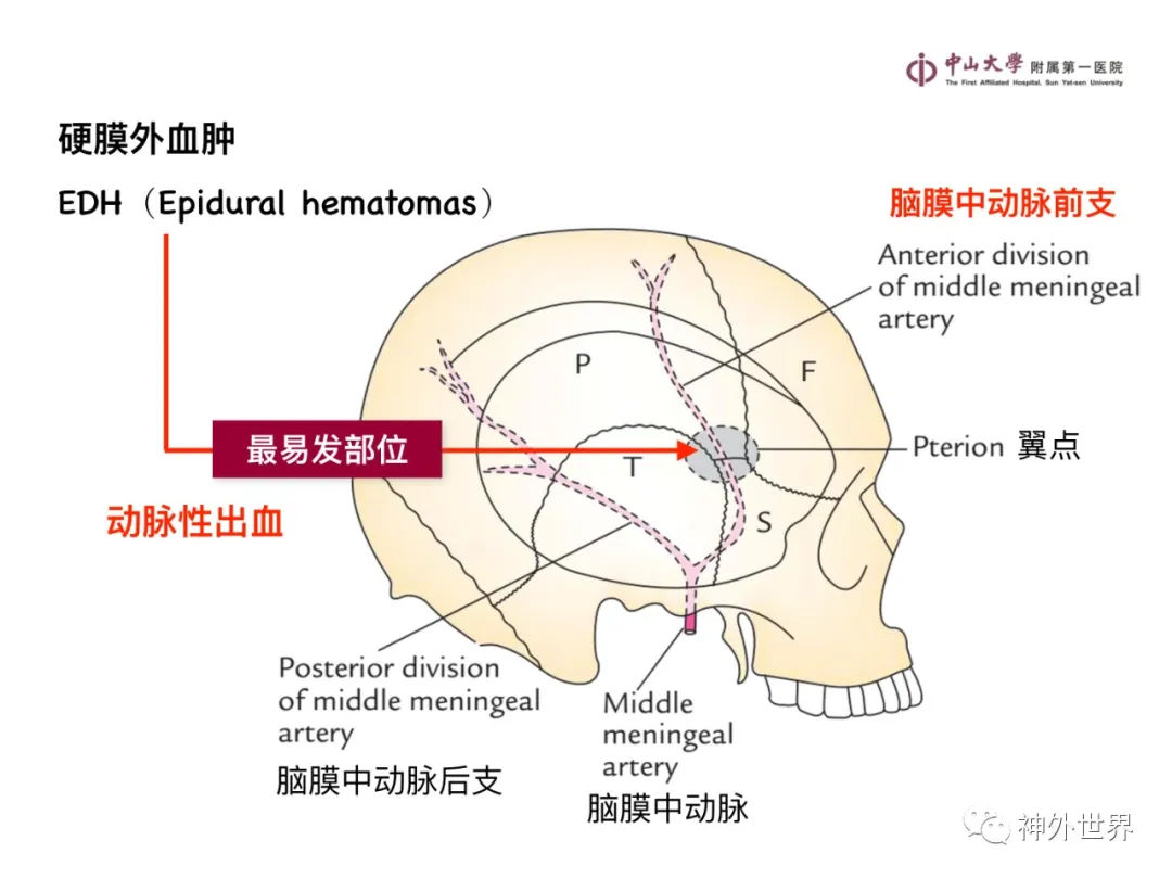 最全影像总结 | 颅内病变 MR、CT 的阅片技巧，太赞了
