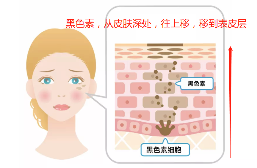 皮膚黑，想美白？美白總是不成功？一次性告訴你變白的全部方法