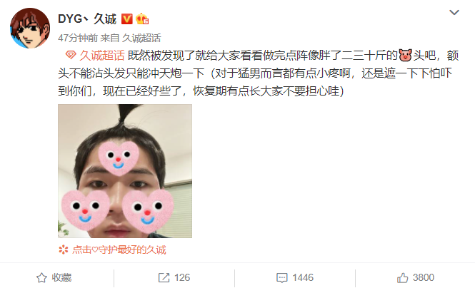 DYG is long sincere winter coronal does not enter the court for certain! Go treating skin convalescence very long, turn sessional whereaboutldirection is sealed