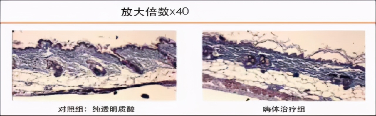 嗨体水光，颠覆你对水光针的认知