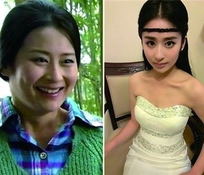 5位瘦成皮包骨的明星，不分男女的减肥，当真要钱不要命？