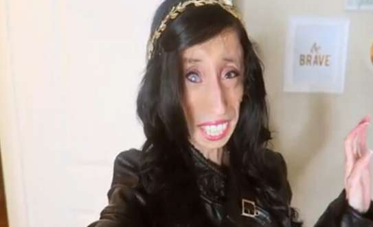 网红\"零脂肪女孩\"，曾经被人恶言相向，