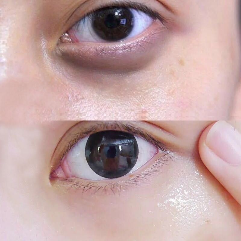 涂眼霜别再用“中指”涂了，太伤皮肤，3个手法改善眼纹黑眼圈