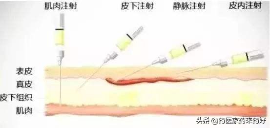 哌拉西林钠他唑巴坦钠优于氨苄西林钠舒巴坦钠吗
