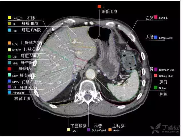 掌握这篇解剖，晋级腹部CT影像诊断高手（精细版）