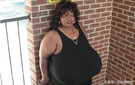 全球乳房最大的女人，一对重达50斤