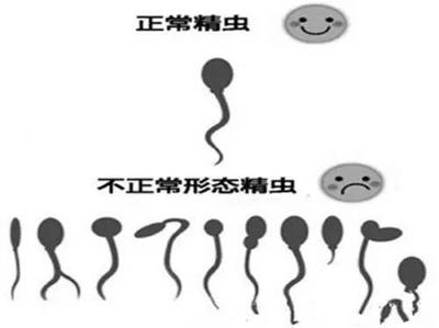 精子畸形是什么鬼？生孩子会不会畸形？