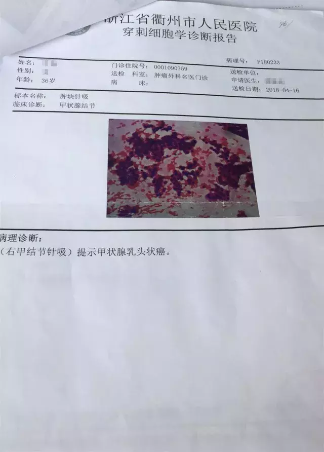 真实理赔案例:XX人寿,这样的拒赔理由我不能接受,法庭见! 第2张 真实理赔案例:XX人寿,这样的拒赔理由我不能接受,法庭见! 第2张