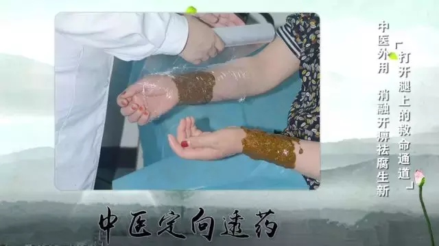 腿脚发凉、发麻?严重者可截肢!提醒身边人警惕这种疾病!