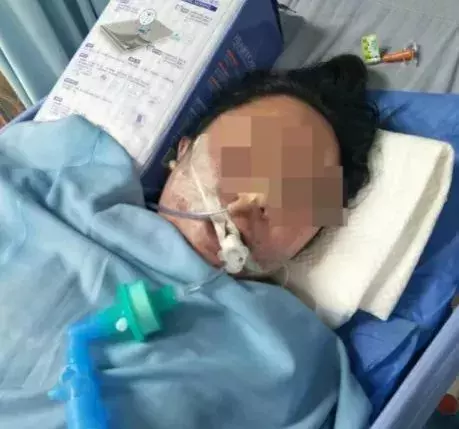 1天连做3项整形手术,女子次日陷入昏迷6天后身亡