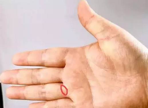 经常捏捏手指头，可以预防五大疾病