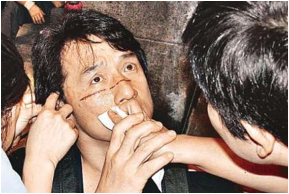 原来明星也这么不易，王嘉尔为了工作生病不就