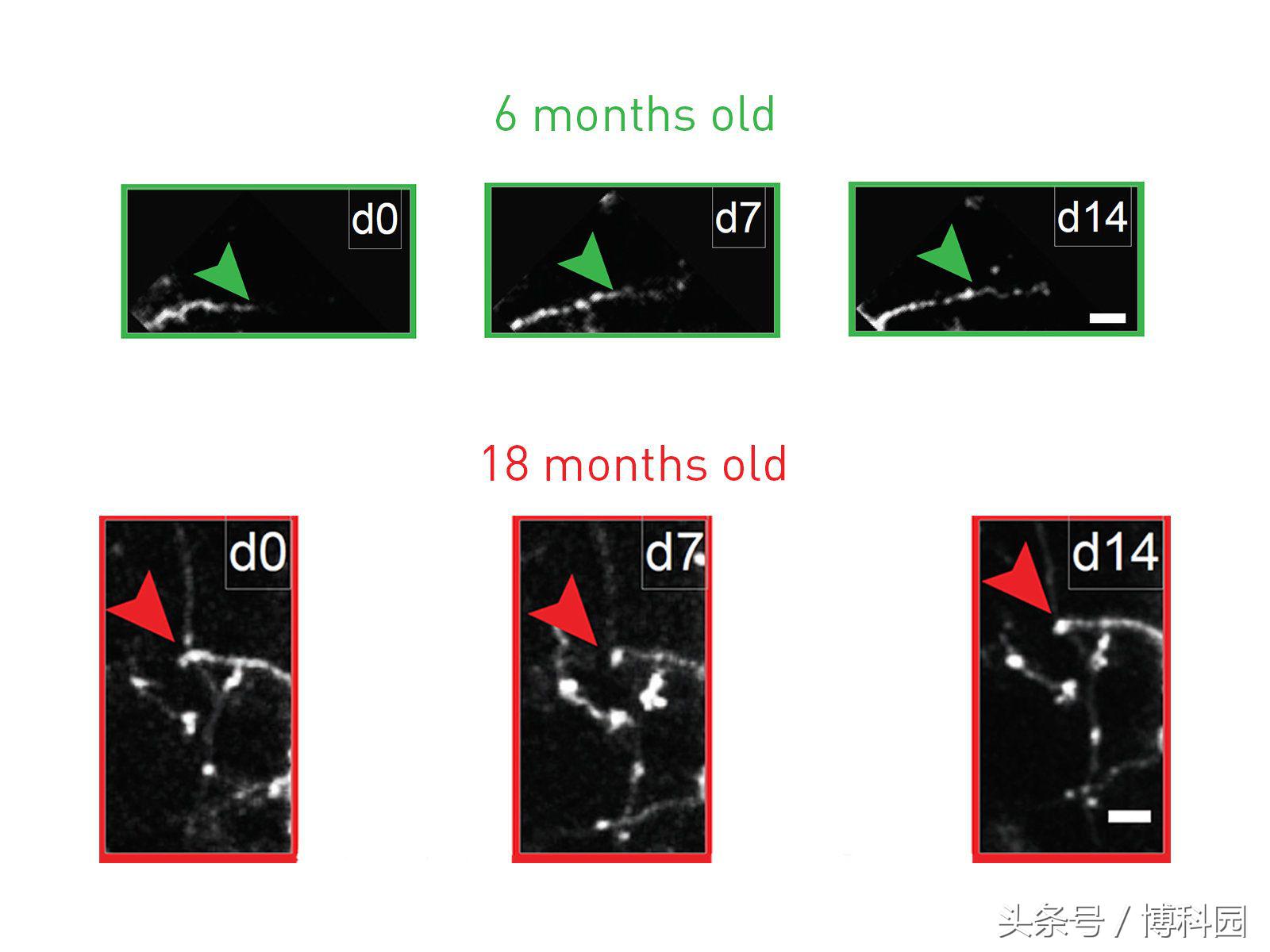 前景？抗抑郁剂能恢复小鼠对衰老抑制神经元的灵活性