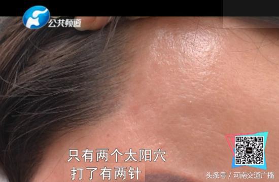 揭开郑州整形医院新型骗局，女子一杯水下肚 44万没了……
